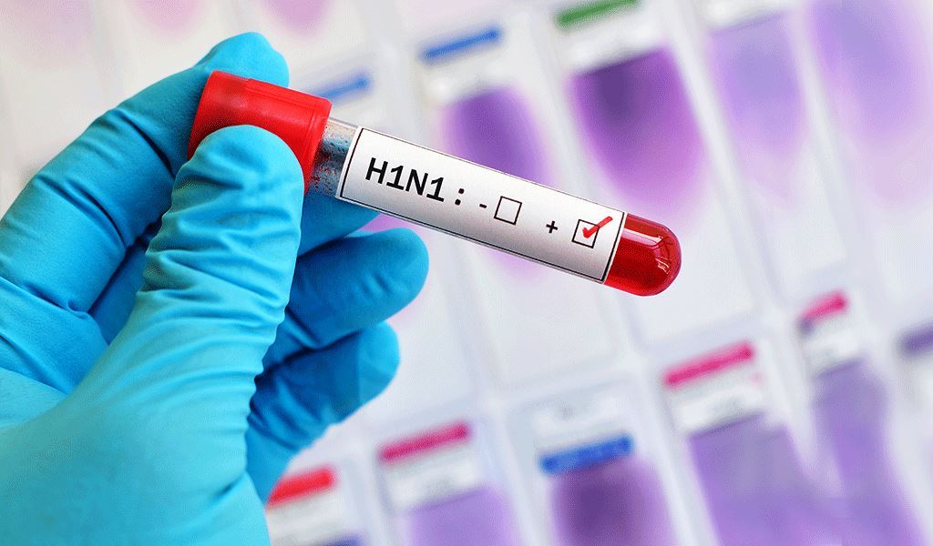Instituto Nacional de Salud confirma que pacientes de Hato Corozal fallecieron por virus AH1N1