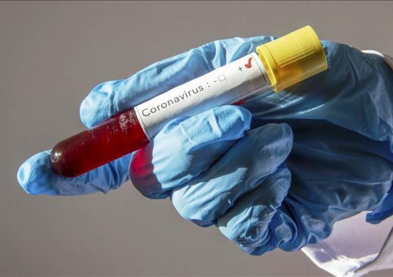 Instituto Nacional de Salud confirma un nuevo caso positivo de COVID-19 en Casanare