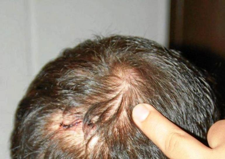 Comerciante de Paz de Ariporo fue golpeado en intento de robo